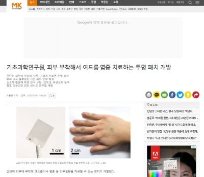 매일경제: 기초과학연구원, 피부 부착해서 여드름·염증 치료하는 투명 패치 개발