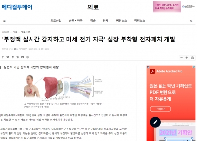 메디컬투데이: '부정맥 실시간 감지하고 미세 전기 자극' 심장 부착형 전자패치 개발