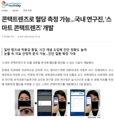 콘택트렌즈로 혈당 측정 가능…국내 연구진, '스마트 콘택트렌즈' 개발