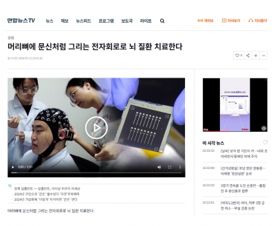 머리뼈에 문신처럼 그리는 전자회로로 뇌 질환 치료한다