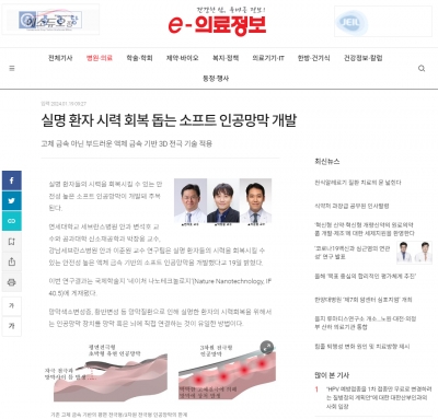 실명 환자 시력 회복 돕는 소프트 인공망막 개발