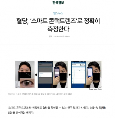 혈당, ‘스마트 콘택트렌즈’로 정확히 측정한다