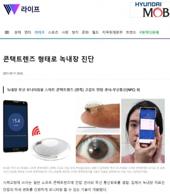 위키트리: 콘택트렌즈 형태로 녹내장 진단