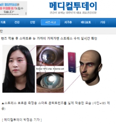 메디컬투데이: 눈물 속 스트레스 호르몬 감지 ‘스마트 콘택트렌즈’ 개발