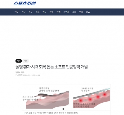 실명 환자 시력 회복 돕는 소프트 인공망막 개발