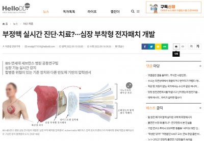 헬로디디: 부정맥 실시간 진단 치료 심장 부착형 전자패치 개발