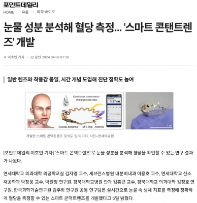 눈물 성분 분석해 혈당 측정... '스마트 콘탠트렌즈' 개발