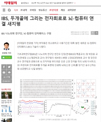 IBS, 두개골에 그리는 전자회로로 뇌-컴퓨터 연결 새지평