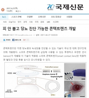 국제신문: 피 안 뽑고 당뇨 진단 가능한 콘택트렌즈 개발