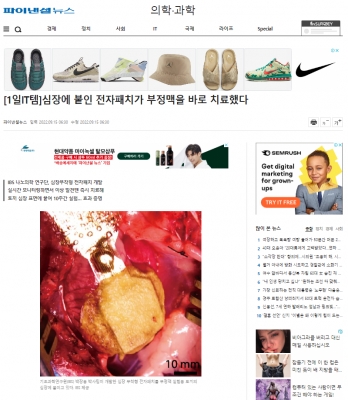 파이낸셜뉴스: [1일IT템]심장에 붙인 전자패치가 부정맥을 바로 치료했다