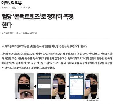 혈당 ‘콘택트렌즈’로 정확히 측정한다