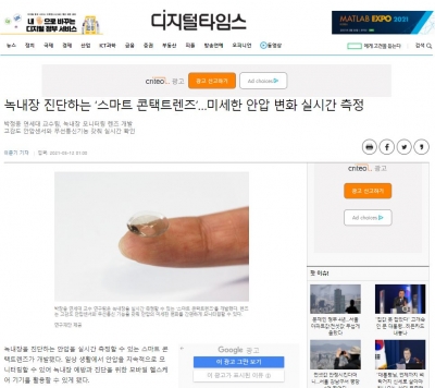 디지털타임스: 녹내장 진단하는 '스마트 콘택트렌즈'...미세한 안압 변화 실시간 측정