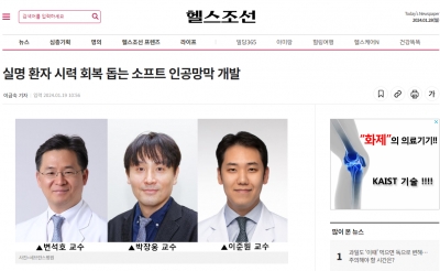 실명 환자 시력 회복 돕는 소프트 인공망막 개발