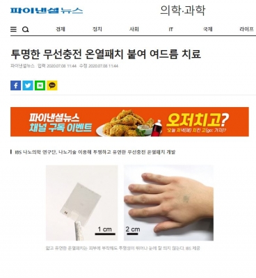 파이낸셜뉴스: 투명한 무선충전 온열패치 붙여 여드름 치료
