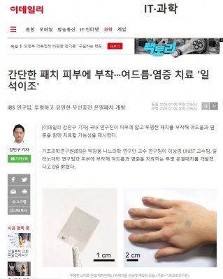 이데일리: 간단한 패치 피부에 부착···여드름·염증 치료 '일석이조'