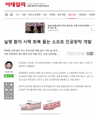실명 환자 시력 회복 돕는 소프트 인공망막 개발