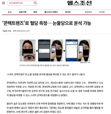 '콘택트렌즈'로 혈당 측정… 눈물당으로 분석 가능 