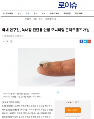 로이슈: 국내 연구진, 녹내장 진단용 안압 모니터링 콘택트렌즈 개발