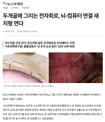 두개골에 그리는 전자회로, 뇌-컴퓨터 연결 새 지평 연다