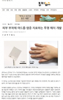 쿠키뉴스: 피부 부착해 여드름·염증 치료하는 투명 패치 개발