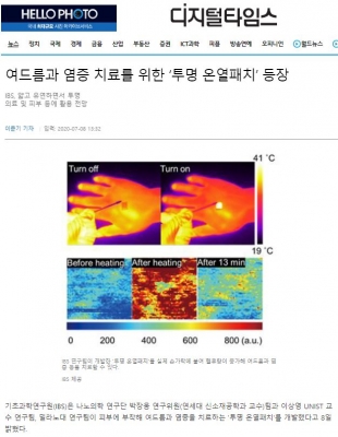 디지털타임스: 여드름과 염증 치료를 위한 ‘투명 온열패치’ 등장