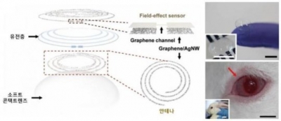 미국 'Science Daily'에 연구결과 소개 ('Smart contact lens sensor' for diabetic and glaucoma diagnosis)