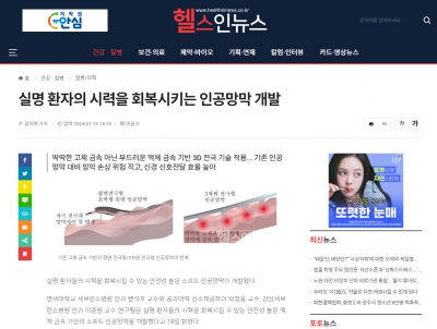 실명 환자의 시력을 회복시키는 인공망막 개발