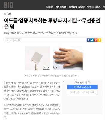 이코노믹리뷰: 여드름·염증 치료하는 투명 패치 개발…무선충전은 덤