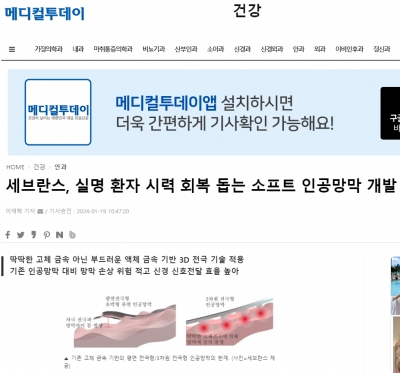 세브란스, 실명 환자 시력 회복 돕는 소프트 인공망막 개발