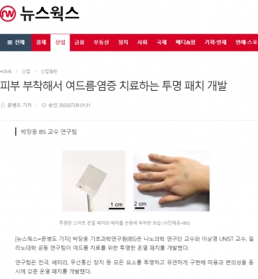 뉴스웍스: 피부 부착해서 여드름·염증 치료하는 투명 패치 개발