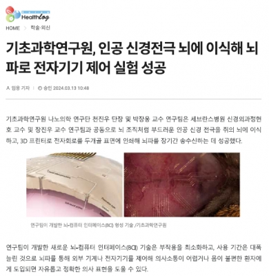 기초과학연구원, 인공 신경전극 뇌에 이식해 뇌파로 전자기기 제어 실험 성공