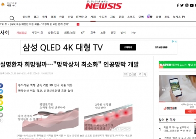 실명환자 희망될까…'망막상처 최소화' 인공망막 개발