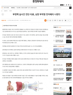 충청투데이: 부정맥 실시간 진단·치료, 심장 부착형 전자패치 나왔다