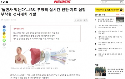 뉴시스: '돌연사 막는다'…IBS, 부정맥 실시간 진단·치료 심장부착형 전자패치 개발