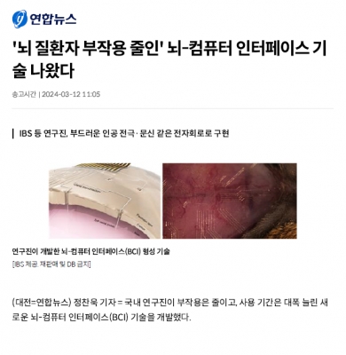 '뇌 질환자 부작용 줄인' 뇌-컴퓨터 인터페이스 기술 나왔다