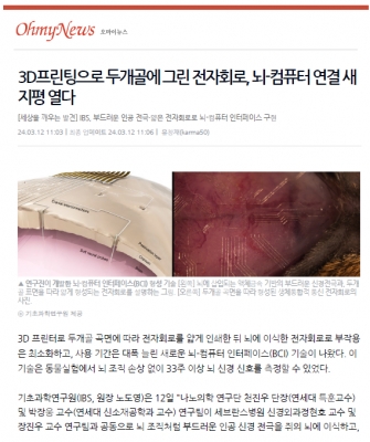 3D프린팅으로 두개골에 그린 전자회로, 뇌-컴퓨터 연결 새지평 열다