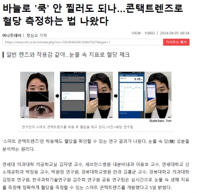 바늘로 '쿡' 안 찔러도 되나…콘택트렌즈로 혈당 측정하는 법 나왔다