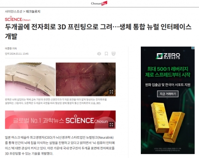 두개골에 전자회로 3D 프린팅으로 그려…생체 통합 뉴럴 인터페이스 개발