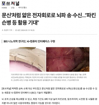 문신처럼 얇은 전자회로로 뇌파 송·수신...'파킨슨병 등 활용 기대'