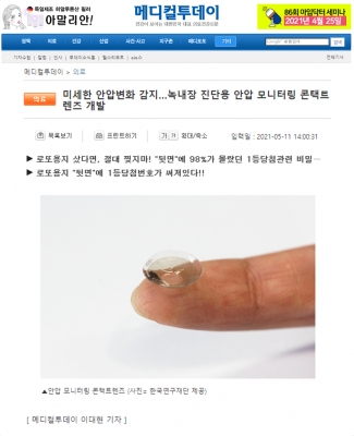 메디컬투데이: 미세한 안압변화 감지...녹내장 진단용 안압 모니터링 콘택트렌즈 개발