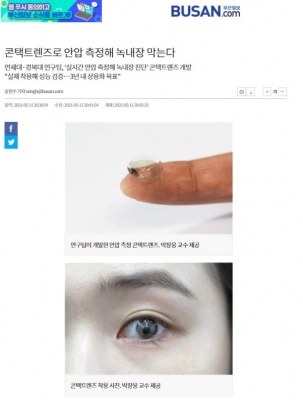 부산일보: 콘택트렌즈로 안압 측정해 녹내장 막는다