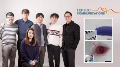 미국 'Science Newsline Technology'에 연구결과 소개 ('Smart contact lens sensor' for diabetic and glaucoma diagnosis)