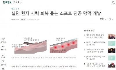 실명 환자 시력 회복 돕는 소프트 인공 망막 개발