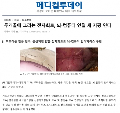 두개골에 그리는 전자회로, 뇌-컴퓨터 연결 새 지평 연다