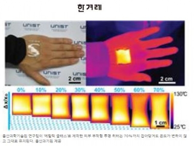 한겨레 : 손등, 옷감에 붙여 쓸 수 있는 '투명히터' 개발