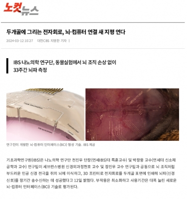두개골에 그리는 전자회로, 뇌-컴퓨터 연결 새 지평 연다