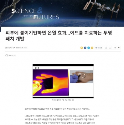 중앙일보: 피부에 붙이기만하면 온열 효과…여드름 치료하는 투명 패치 개발