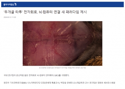 '두개골 타투' 전자회로, 뇌·컴퓨터 연결 새 패러다임 제시