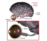 [2019] Implantation of electronic visual prosthesis for blindness restoration