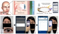 [2024] In-depth correlation analysis between tear glucose and blood glucose using a wireless smart contact lens